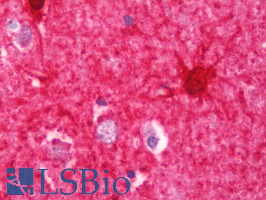 IHC-plus™ CKB / Creatine Kinase BB Antibody (aa165-381)