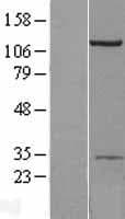 AP2B1 Protein (Over-Expression Lysate Myc-DDK (Flag))