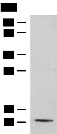PCBD1 / PHS Antibody