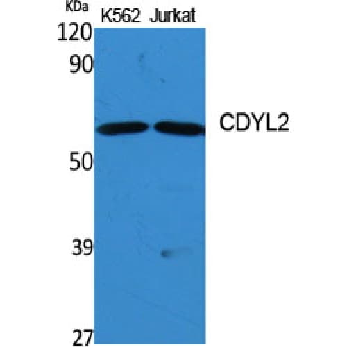 Polyclonal Rabbit anti-Human CDYL2 Antibody (1-80 aa, N-terminal, IHC, WB)