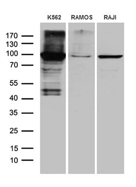 MPS1 / TTK Antibody (aa189-464, clone OTI1D4)