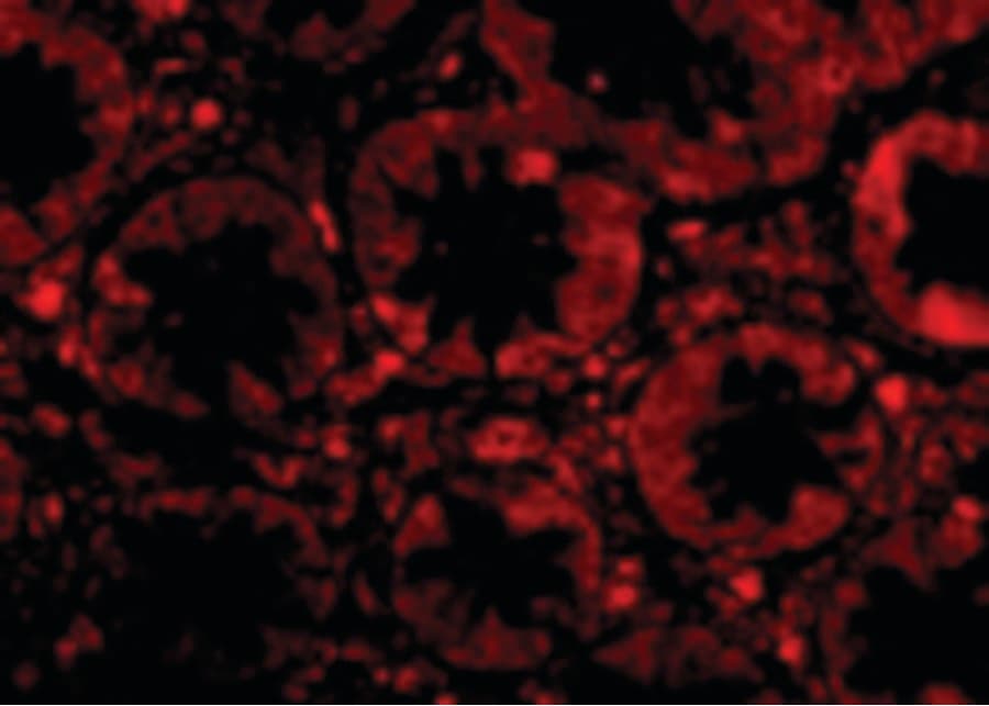 TEM1 / CD248 Antibody