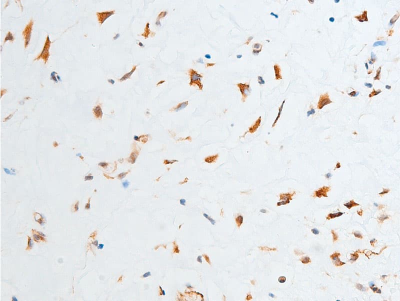 CHEK2 / CHK2 Antibody (phospho-Thr387)