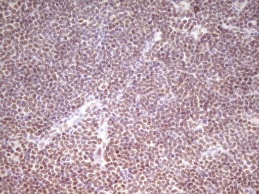 HMG20A Antibody (aa1-281, clone OTI2H4)