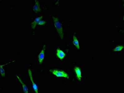 SART2 / DSE Antibody