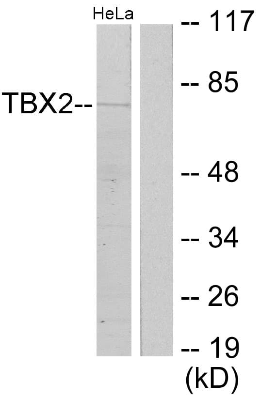 TBX2 Antibody (aa251-300)