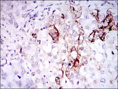 SST / Somatostatin Antibody (clone 7G5)