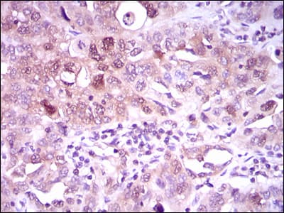 Monoclonal Mouse anti-Human ACLY / ATP Citrate Lyase Antibody (clone 5F8D11, IHC, IF, WB)