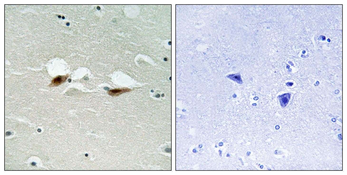 ATF2 Antibody (phospho-Ser472)