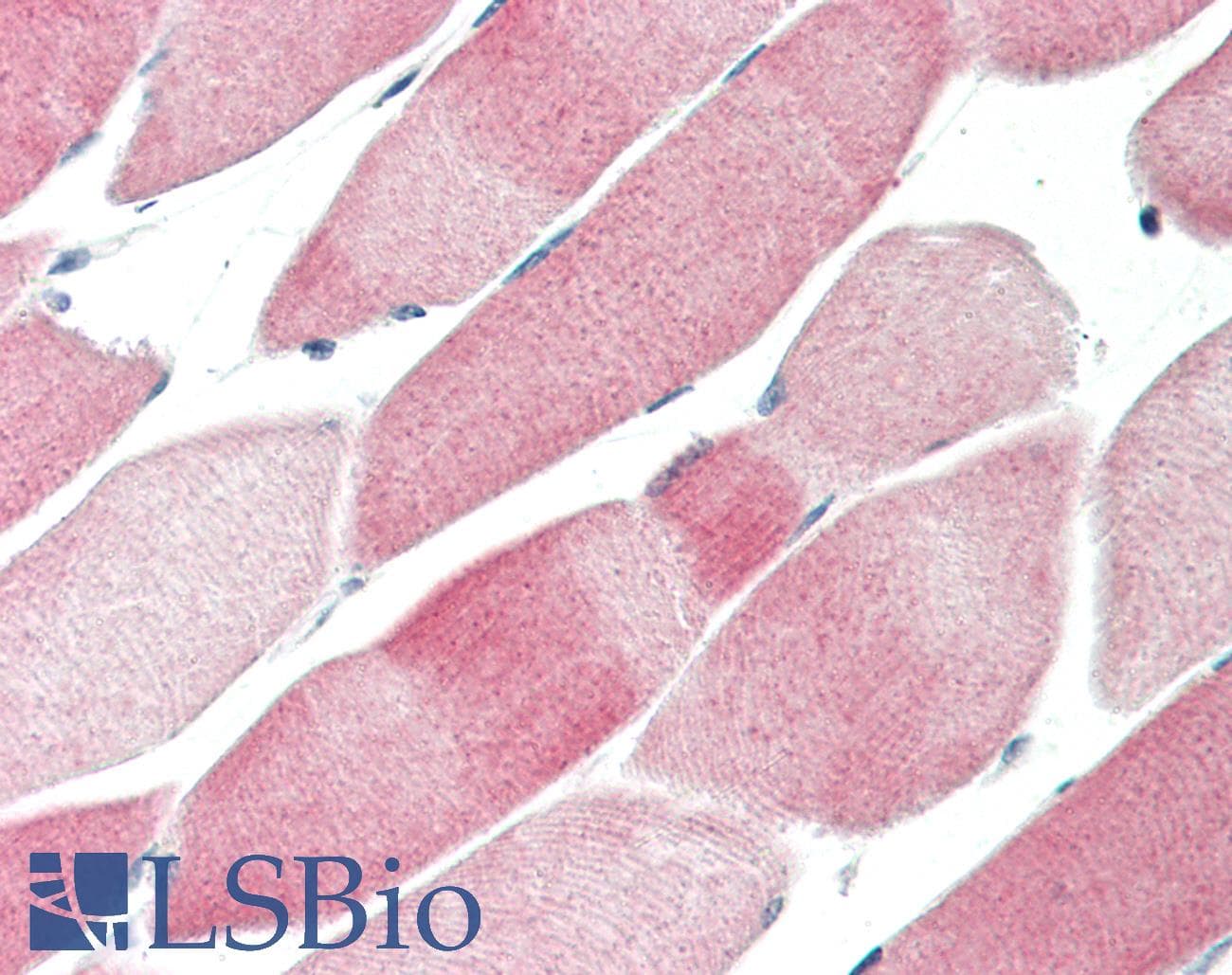 WDFY1 Antibody (N-Terminus)