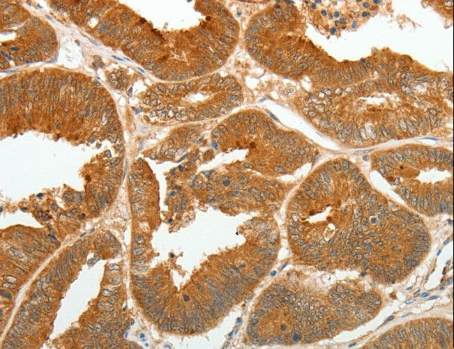 ASCL1 / MASH1 Antibody