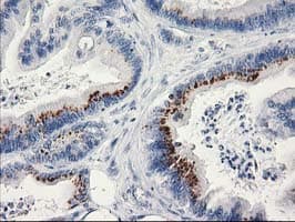 MGLL / Monoacylglycerol Lipase Antibody (clone OTI2G8)