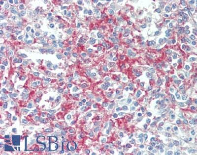 IHC-plus™ DNAM-1 / CD226 Antibody (aa286-336)