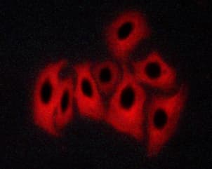 CAMK2A / CaMKII Alpha Antibody (phospho-Thr286)