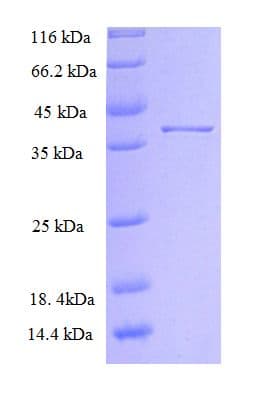 Rat SLC39A13 / ZIP13 Protein (Recombinant His-GST)