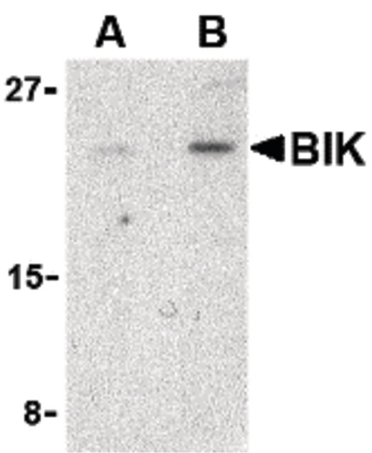 IHC-plus™ Polyclonal Rabbit anti-Human BIK Antibody (IHC, IF, WB)