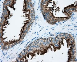 PRKAR2A Antibody (clone OTI4A3)