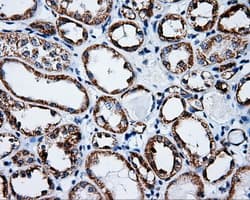 TLDC1 / KIAA1609 Antibody (clone OTI7E4)