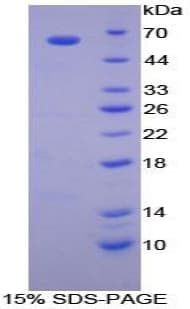 Dog CCL4 / MIP-1 Beta Protein (Recombinant His-GST)