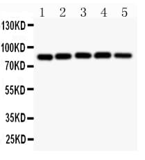 Polyclonal Rabbit anti-Human CHUK / IKKA / IKK Alpha Antibody (aa411-745, IHC, WB)