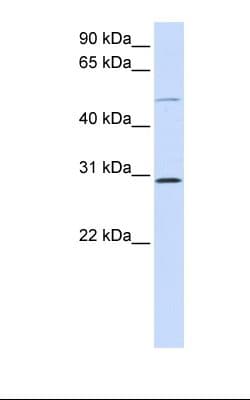 PSPLA1 / Phospholipase A1 Antibody (aa218-267)