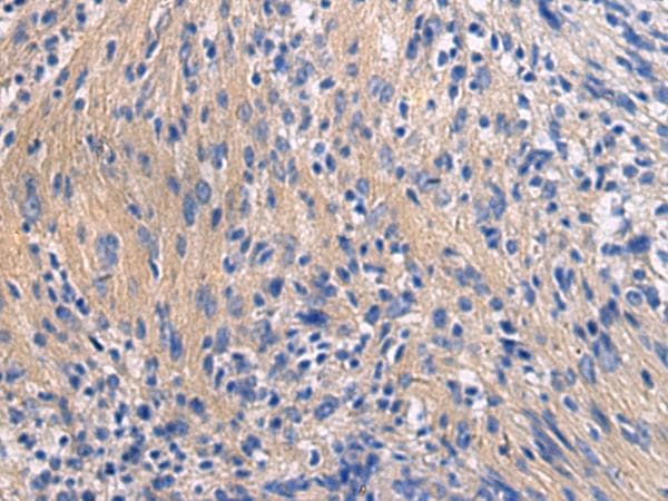 GALR3 / Galanin Receptor 3 Antibody