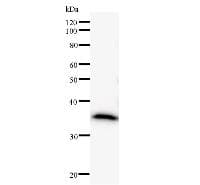 DDX5 Antibody (clone 2257C3a)