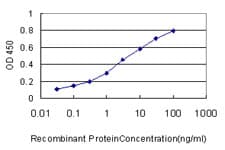 IHC-plus™ Monoclonal Mouse anti-Human SMARCB1 / INI1 Antibody (clone 3E10, IHC, WB)