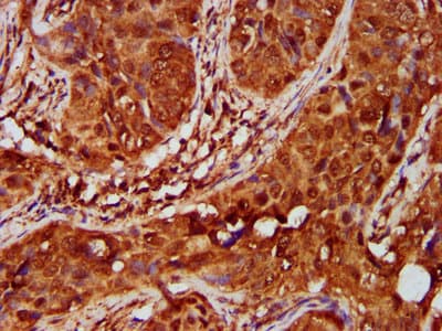 IKBKAP / IKAP Antibody