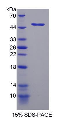 Human LPCAT1 / AYTL2 Protein (Recombinant His-S)