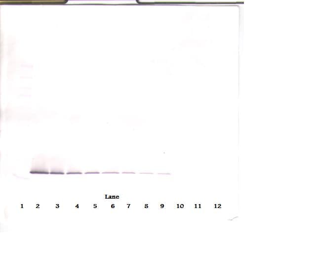 IHC-plus™ Polyclonal Rabbit anti-Human Endostatin Antibody (IHC, WB)