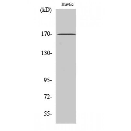 SMARCC2 Antibody (330-410 aa, Internal)