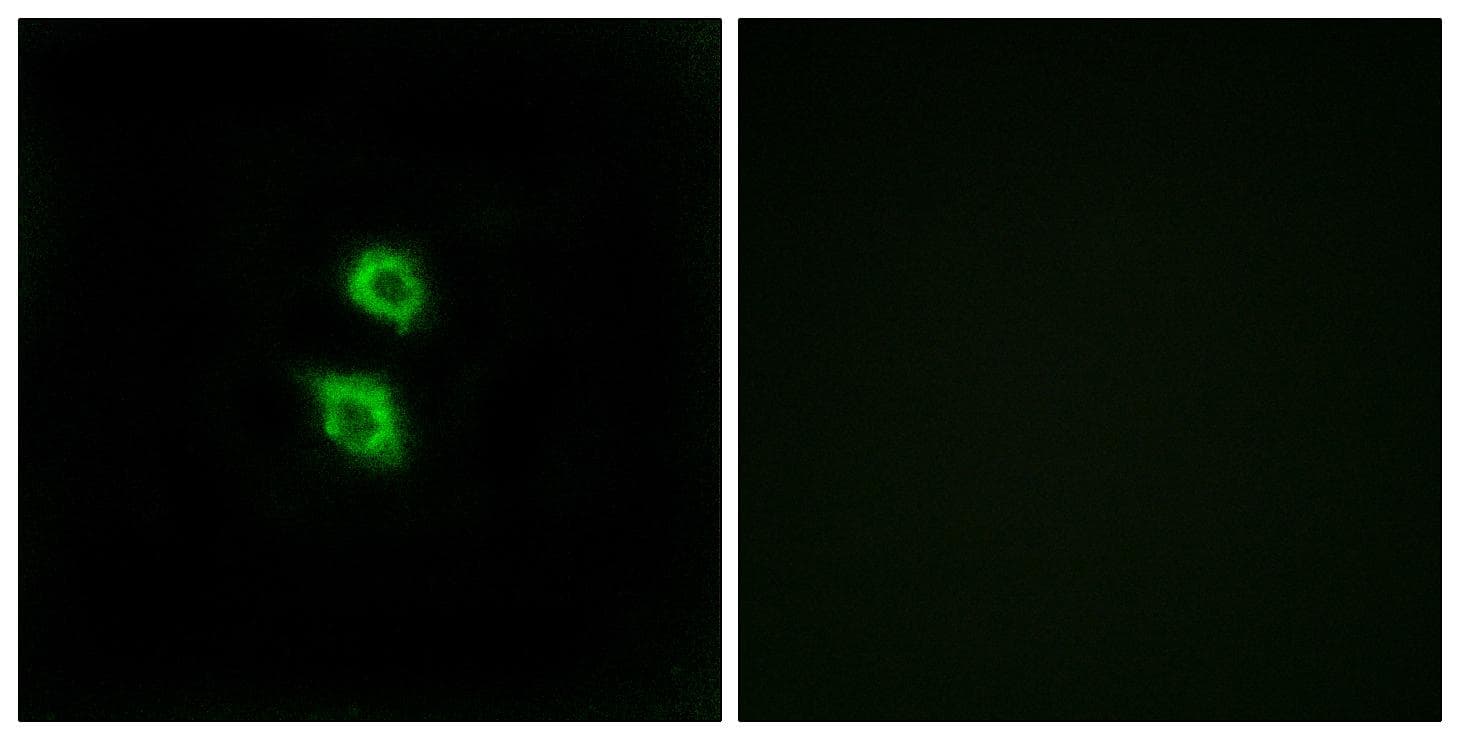 ARSD / Arylsulfatase D Antibody