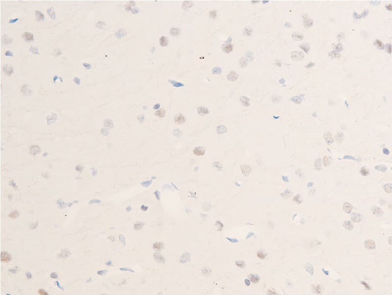 CHEK1 / CHK1 Antibody (phospho-Ser301)