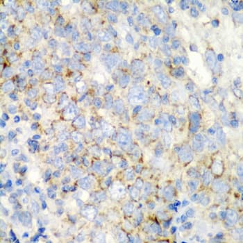 PRKCQ / PKC-Theta Antibody