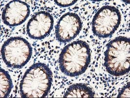 P5CR2 / PYCR2 Antibody (clone OTI3D1)