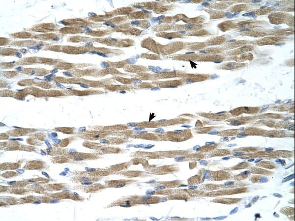 MYC / c-Myc Antibody (N-Terminus)