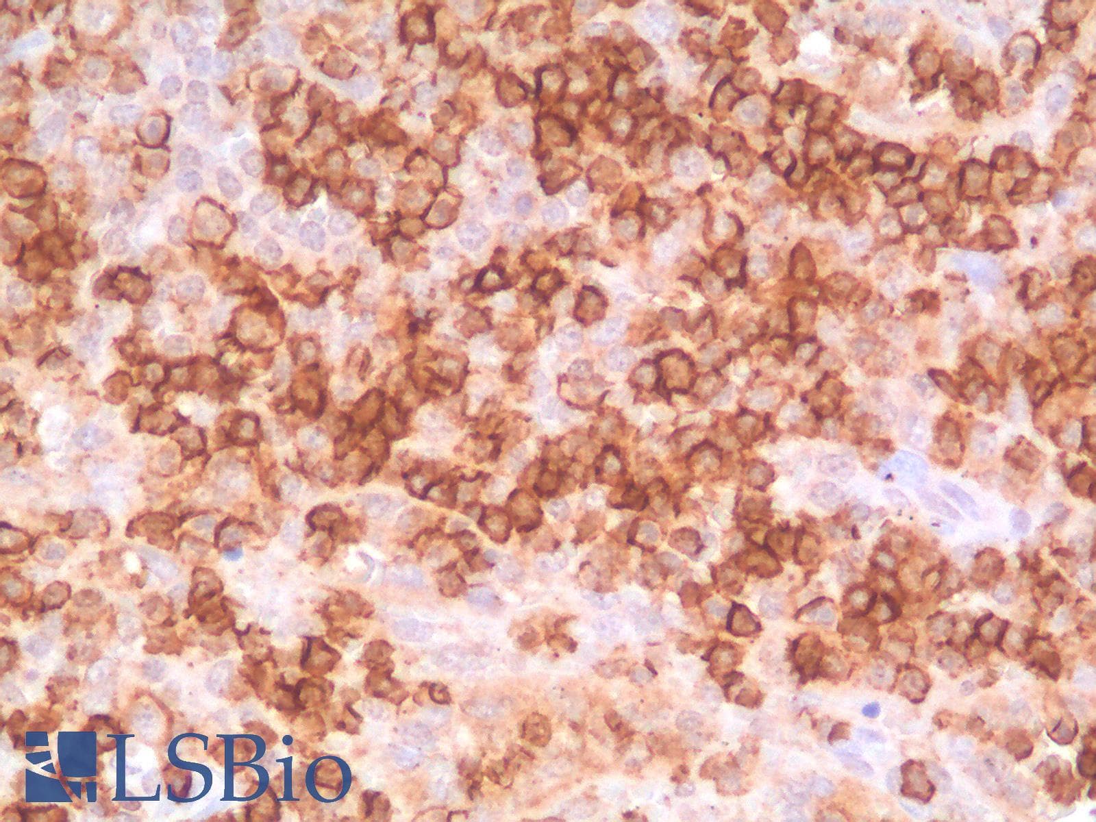 PathPlus™ SPN / CD43 Antibody (clone SPN/1766R)