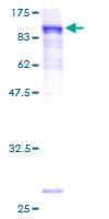 Human PRICKLE3 / LMO6 Protein (Recombinant GST)