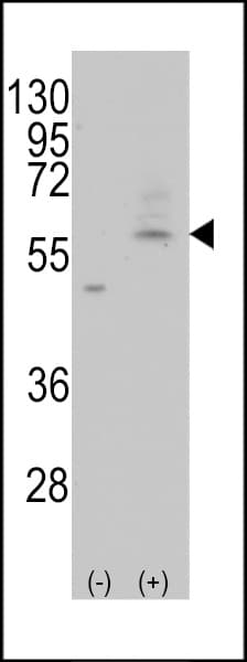 SLC29A4 Antibody (aa452-481)