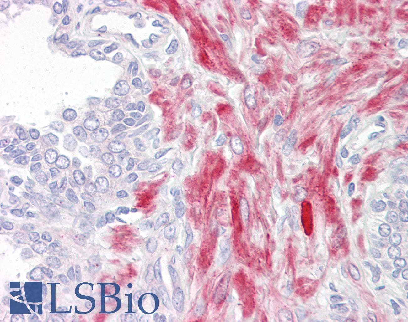 IHC-plus™ ADGRL2 / LPHN2 Antibody (aa551-600)