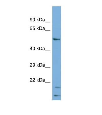 Polyclonal Rabbit anti-Human Cytochrome P450 2R1 / CYP2R1 Antibody (C-Terminus, WB)