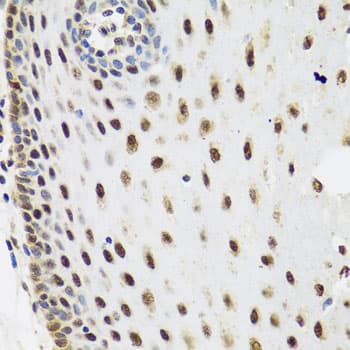 IHC-plus™ Polyclonal Rabbit anti-Human SKIV2L2 Antibody (IHC, WB)