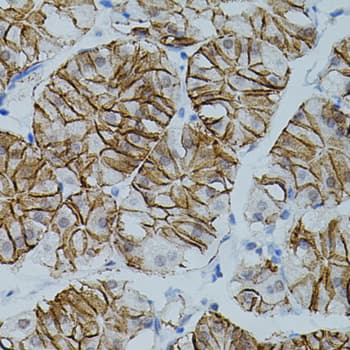 CLDN3 / Claudin 3 Antibody