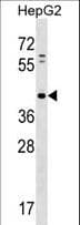 LPPR5 Antibody (aa78-106)
