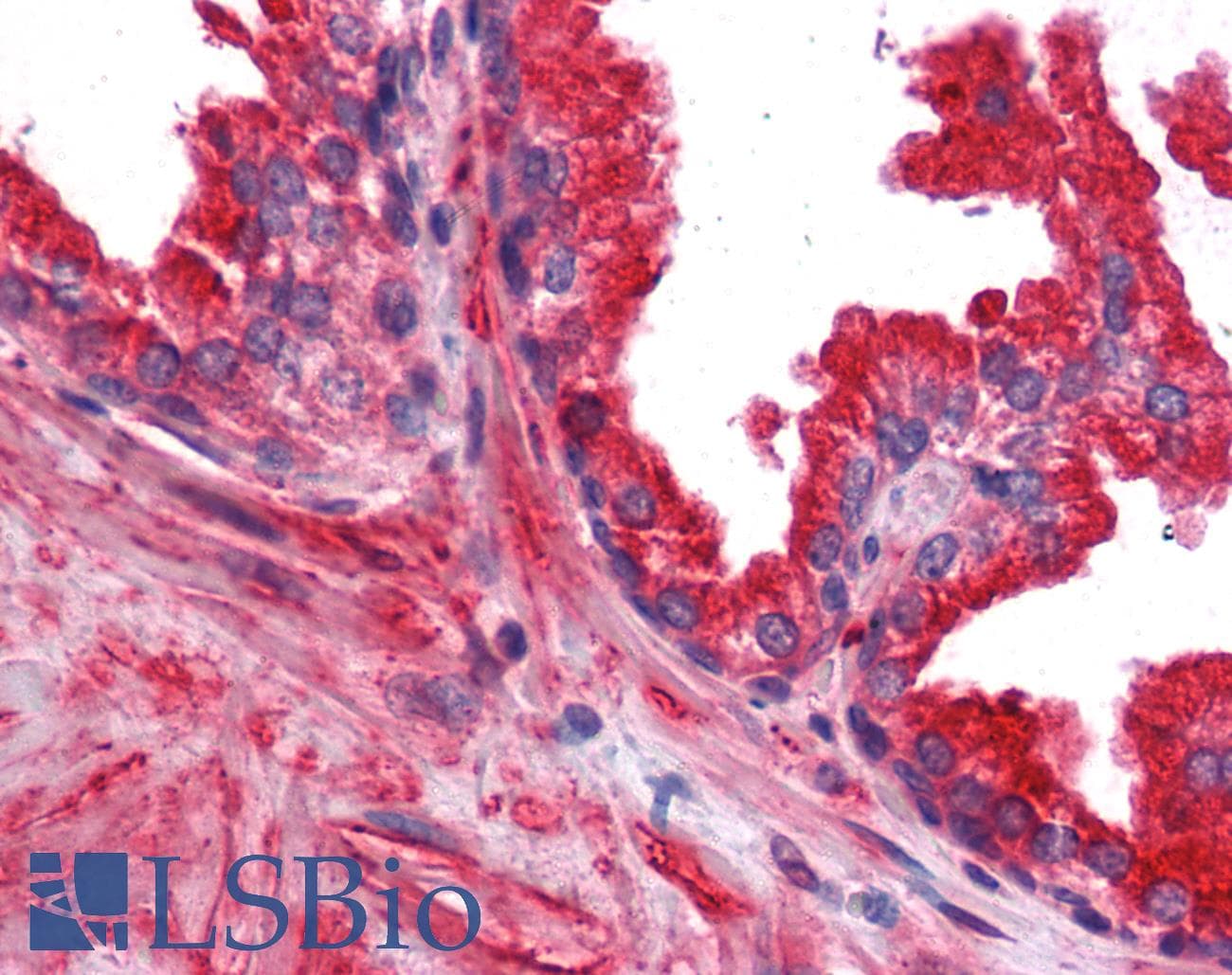 IHC-plus™ TC21 / RRAS2 Antibody (clone 2D3-4B8)