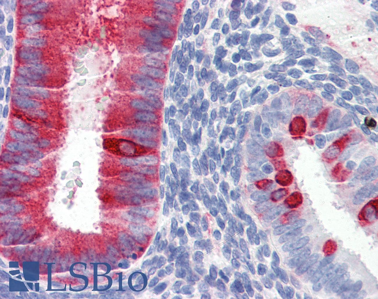 IHC-plus™ Monoclonal Mouse anti-Human HSPB1 / HSP27 Antibody (clone 2A5, aa1-205, IHC, WB)