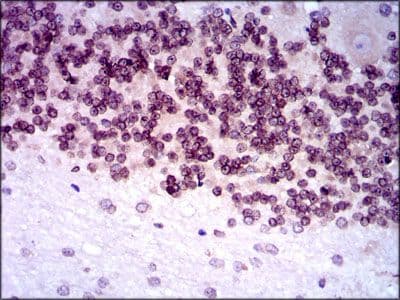 NR6A1 / GCNF Antibody (Amino Acid: 65-118, clone 4G8)