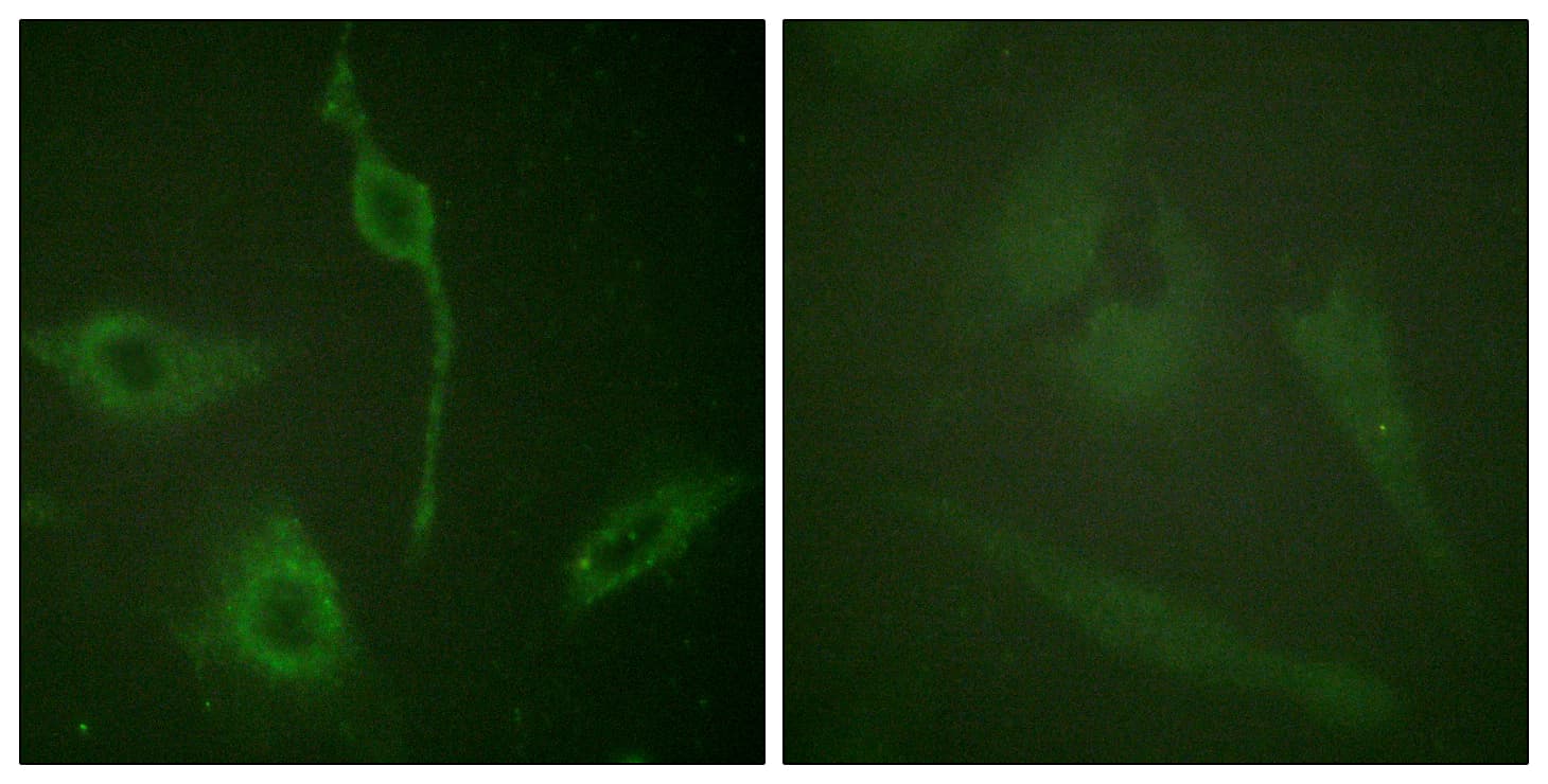 Polyclonal Rabbit anti-Human PDGFRA / PDGFR Alpha Antibody (aa731-780, IHC, IF)