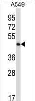 PHKG2 Antibody (aa2-29)